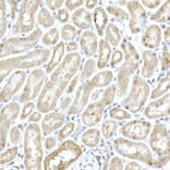 Immunohistochemistry - Anti-MTAP Antibody (A12960) - Antibodies.com