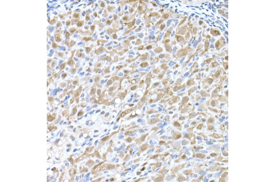Immunohistochemistry - Anti-MTAP Antibody (A12960) - Antibodies.com