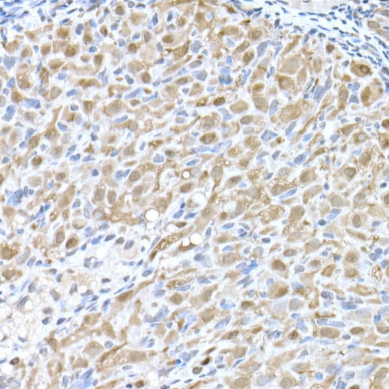 Immunohistochemistry - Anti-MTAP Antibody (A12960) - Antibodies.com