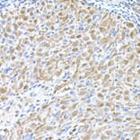 Immunohistochemistry - Anti-MTAP Antibody (A12960) - Antibodies.com