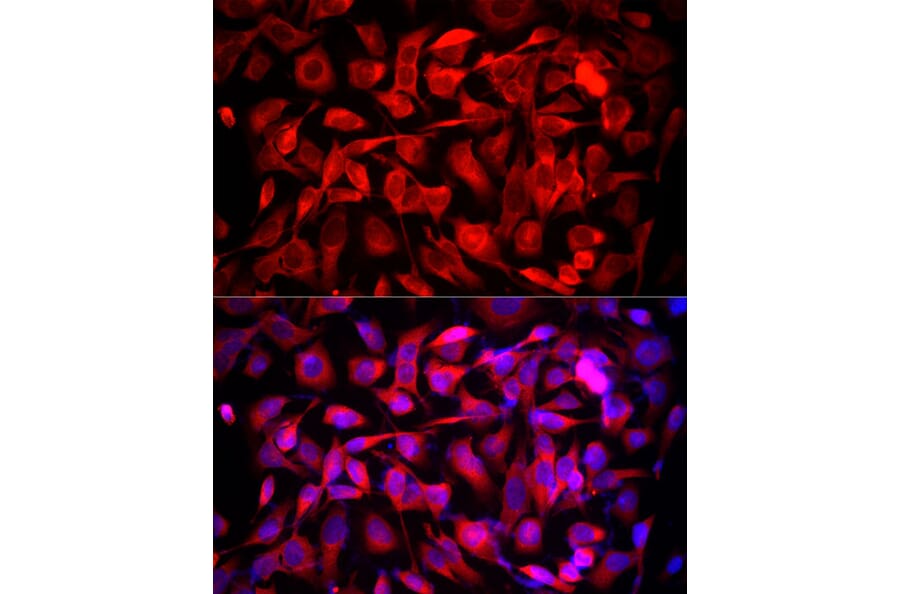 Immunofluorescence - Anti-MTAP Antibody (A12960) - Antibodies.com