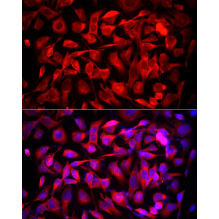 Immunofluorescence - Anti-MTAP Antibody (A12960) - Antibodies.com