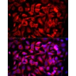 Immunofluorescence - Anti-MTAP Antibody (A12960) - Antibodies.com