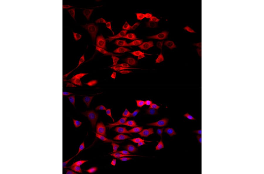Immunofluorescence - Anti-MTAP Antibody (A12960) - Antibodies.com