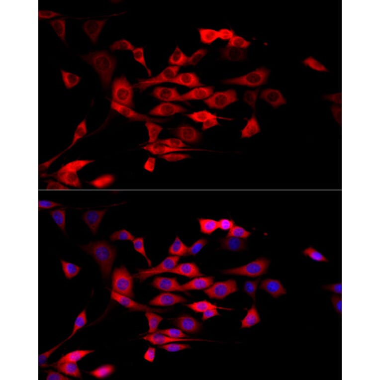 Immunofluorescence - Anti-MTAP Antibody (A12960) - Antibodies.com