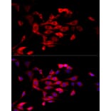 Immunofluorescence - Anti-MTAP Antibody (A12960) - Antibodies.com