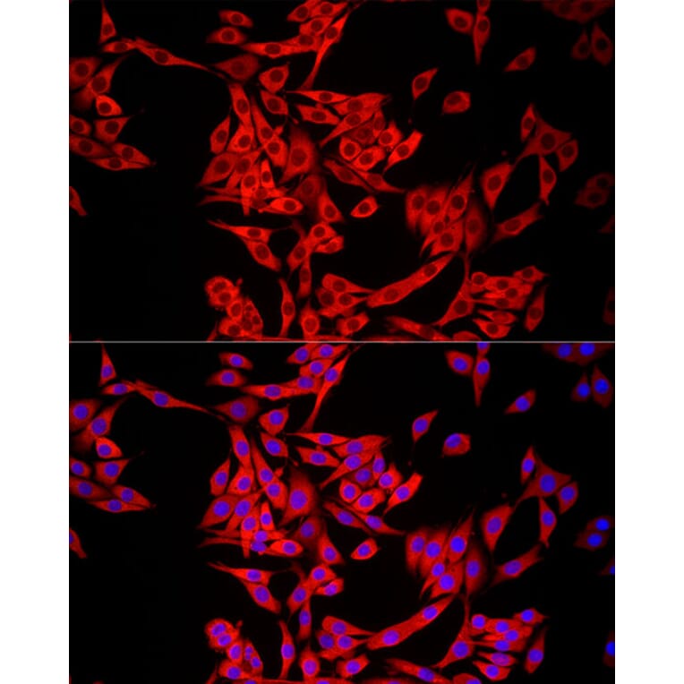 Immunofluorescence - Anti-MTAP Antibody (A12960) - Antibodies.com