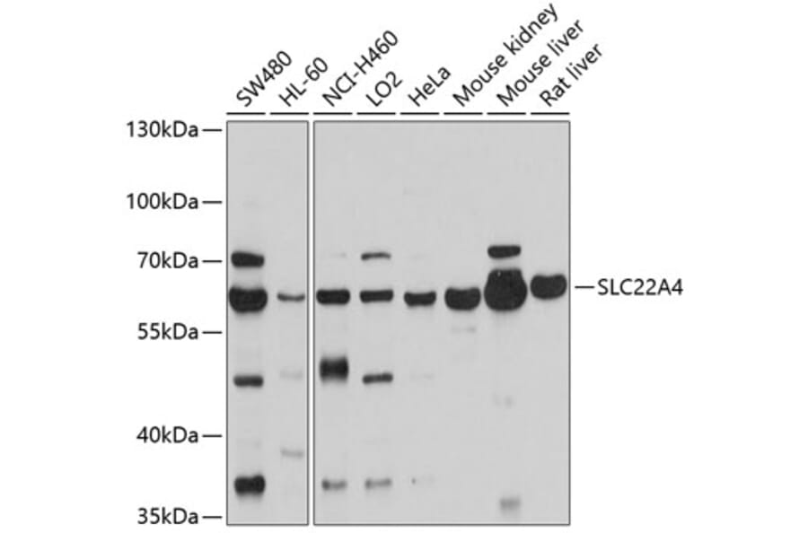 Western Blot - Anti-SLC22A4/ETT Antibody (A12961) - Antibodies.com