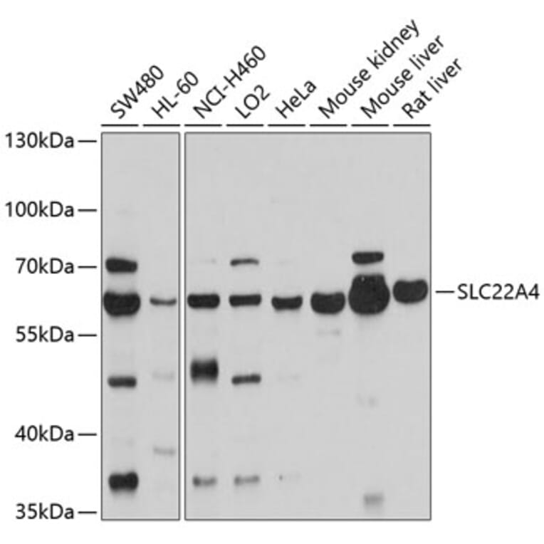 Western Blot - Anti-SLC22A4/ETT Antibody (A12961) - Antibodies.com