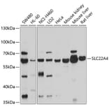 Western Blot - Anti-SLC22A4/ETT Antibody (A12961) - Antibodies.com