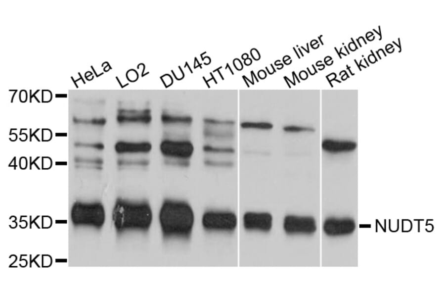 Western Blot - Anti-NUDT5 Antibody (A10493) - Antibodies.com