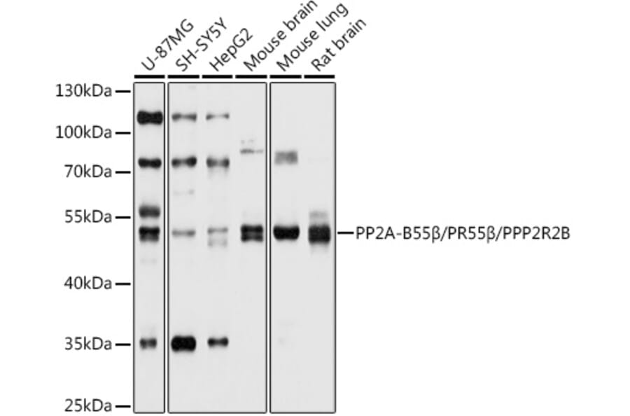 Western Blot - Anti-PPP2R2B Antibody (A12963) - Antibodies.com