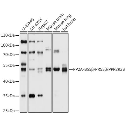 Western Blot - Anti-PPP2R2B Antibody (A12963) - Antibodies.com