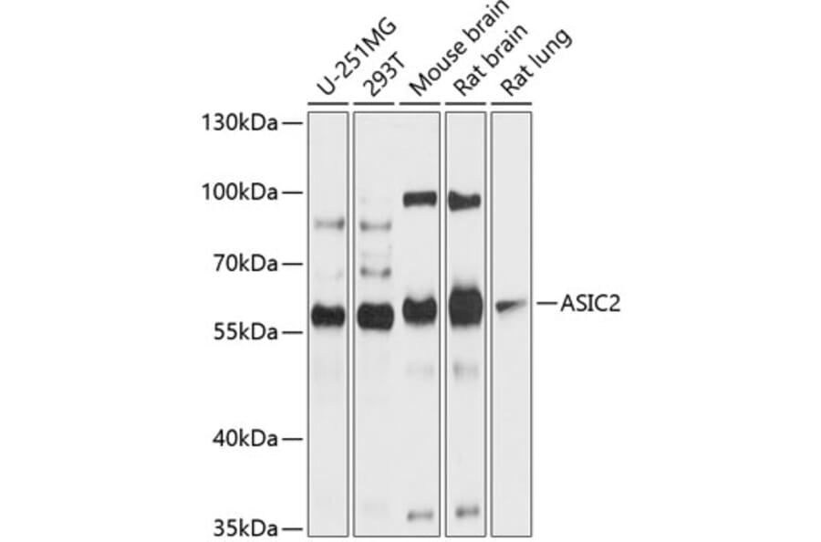 Western Blot - Anti-ASIC2 Antibody (A12964) - Antibodies.com