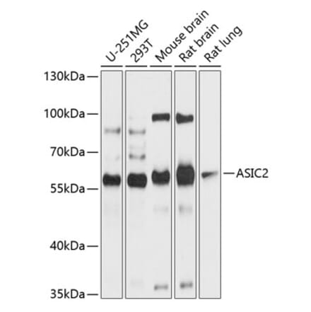 Western Blot - Anti-ASIC2 Antibody (A12964) - Antibodies.com