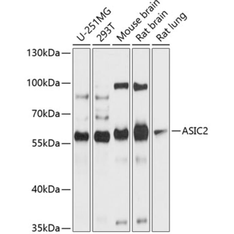 Western Blot - Anti-ASIC2 Antibody (A12964) - Antibodies.com