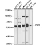 Western Blot - Anti-ASIC2 Antibody (A12964) - Antibodies.com