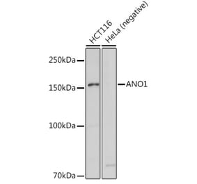 Western Blot - Anti-TMEM16A Antibody (A12965) - Antibodies.com
