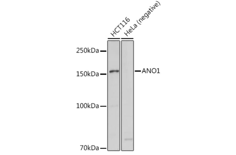 Western Blot - Anti-TMEM16A Antibody (A12965) - Antibodies.com