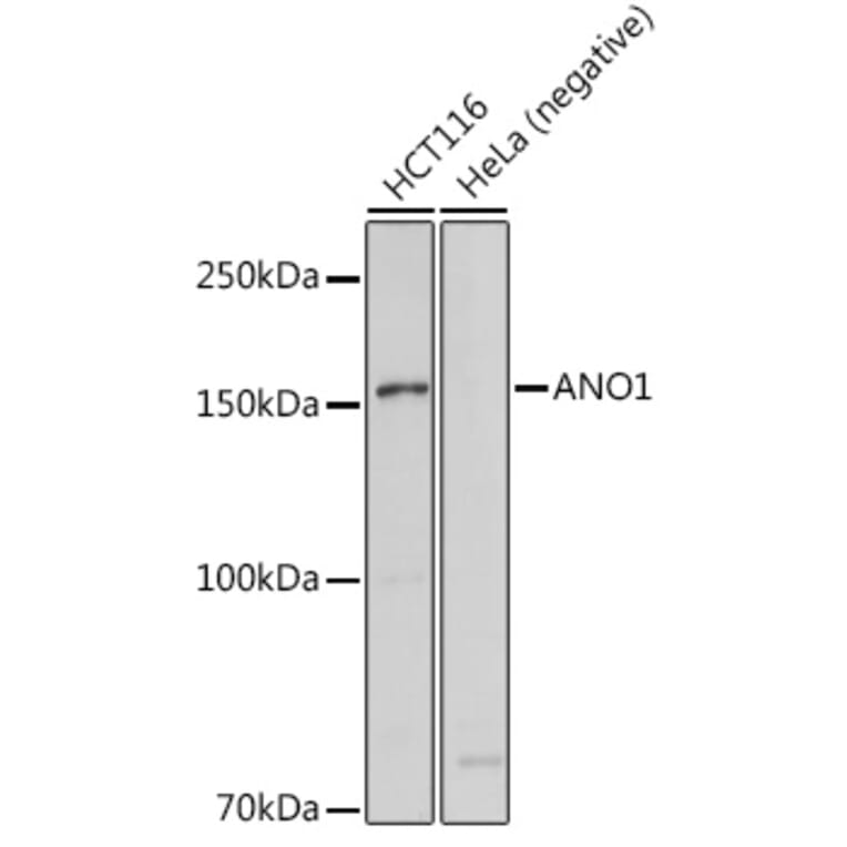 Western Blot - Anti-TMEM16A Antibody (A12965) - Antibodies.com