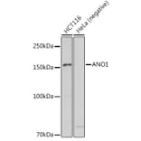 Western Blot - Anti-TMEM16A Antibody (A12965) - Antibodies.com