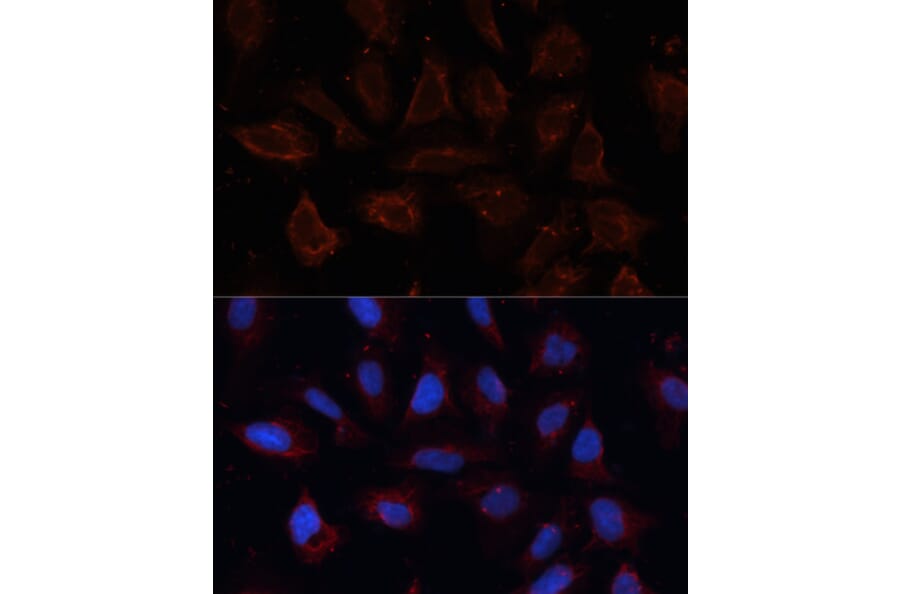 Immunofluorescence - Anti-TMEM16A Antibody (A12965) - Antibodies.com