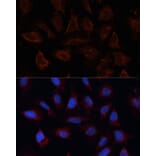 Immunofluorescence - Anti-TMEM16A Antibody (A12965) - Antibodies.com