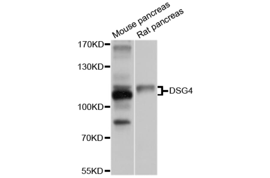Western Blot - Anti-DSG4 Antibody (A10502) - Antibodies.com