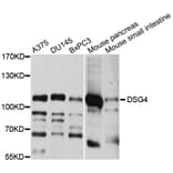 Western Blot - Anti-DSG4 Antibody (A10502) - Antibodies.com