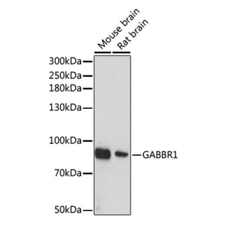 Western Blot - Anti-GABA B Receptor 1 Antibody (A12968) - Antibodies.com