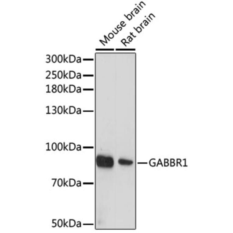 Western Blot - Anti-GABA B Receptor 1 Antibody (A12968) - Antibodies.com