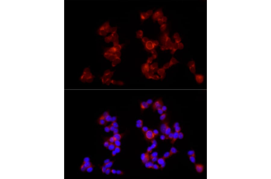 Immunofluorescence - Anti-GABA B Receptor 1 Antibody (A12968) - Antibodies.com