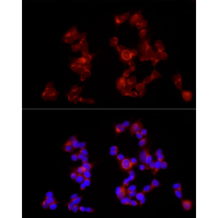 Immunofluorescence - Anti-GABA B Receptor 1 Antibody (A12968) - Antibodies.com