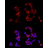 Immunofluorescence - Anti-GABA B Receptor 1 Antibody (A12968) - Antibodies.com