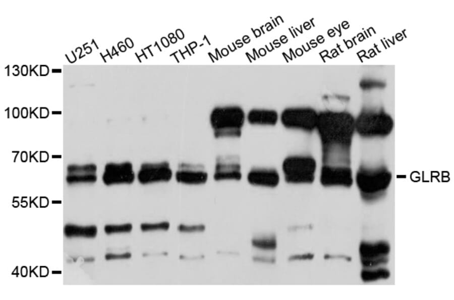 Western Blot - Anti-GLRB Antibody (A10505) - Antibodies.com