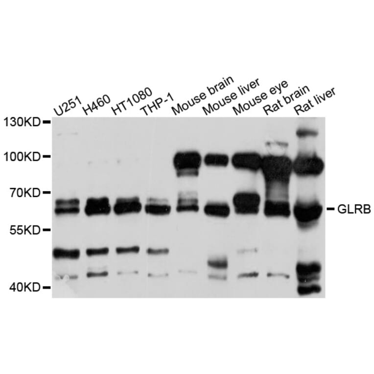 Western Blot - Anti-GLRB Antibody (A10505) - Antibodies.com