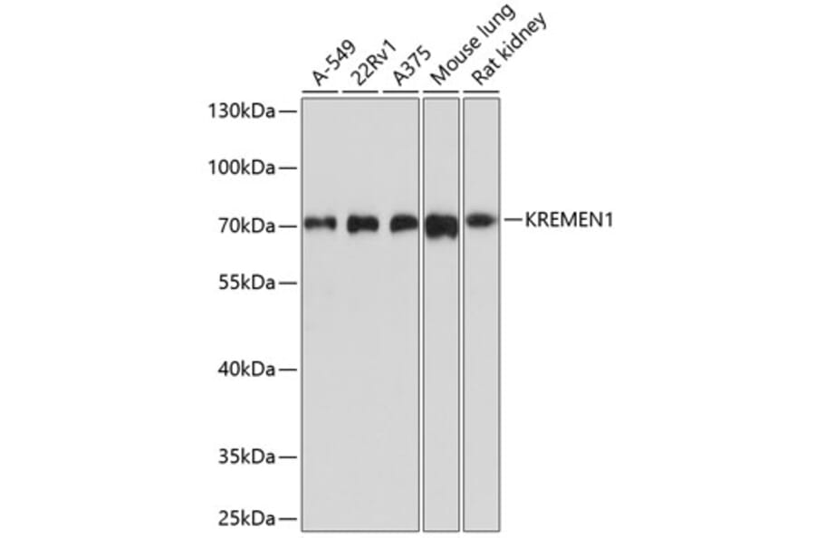 Western Blot - Anti-KREMEN1 Antibody (A12970) - Antibodies.com