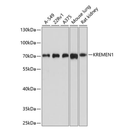 Western Blot - Anti-KREMEN1 Antibody (A12970) - Antibodies.com