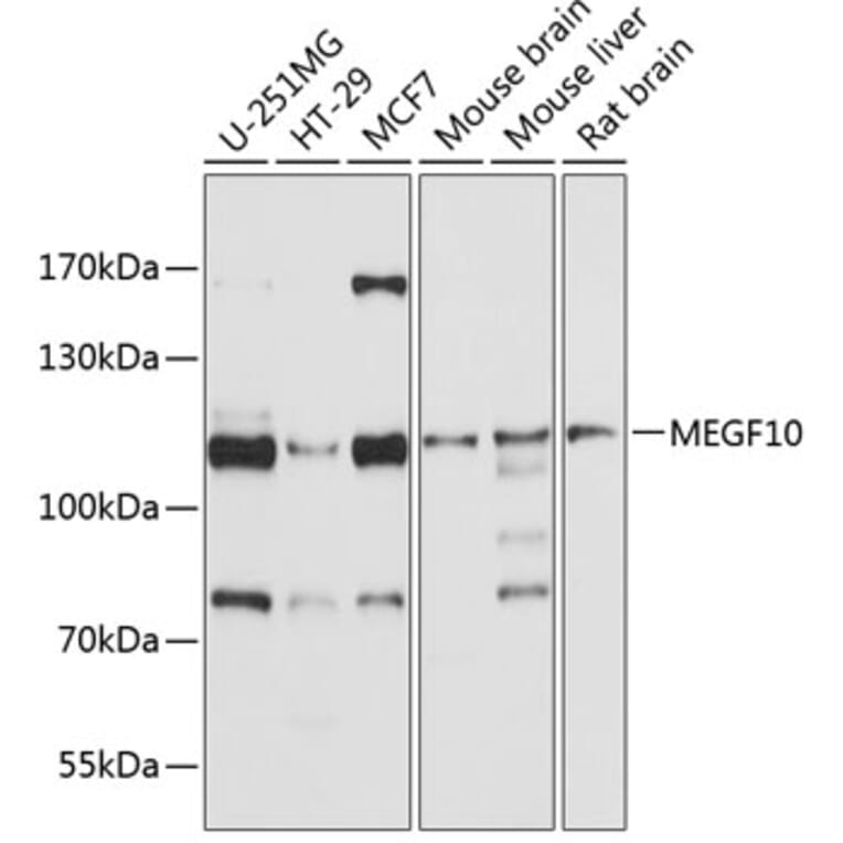 Western Blot - Anti-MEGF10 Antibody (A12971) - Antibodies.com