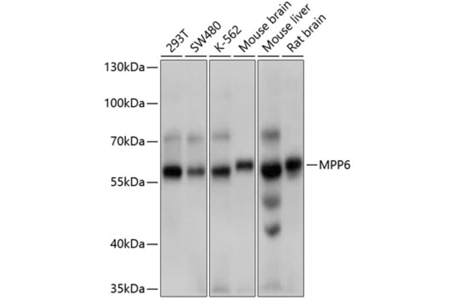 Western Blot - Anti-VAM1 Antibody (A12972) - Antibodies.com