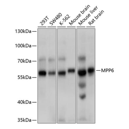 Western Blot - Anti-VAM1 Antibody (A12972) - Antibodies.com