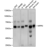 Western Blot - Anti-VAM1 Antibody (A12972) - Antibodies.com