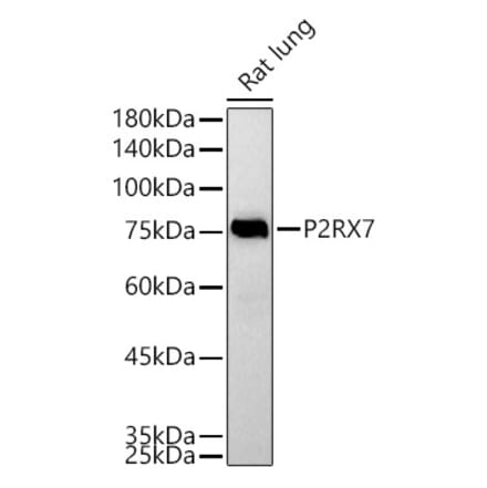 Western Blot - Anti-P2X7 Antibody (A12973) - Antibodies.com