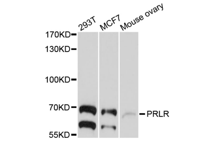 Western Blot - Anti-PRLR Antibody (A10513) - Antibodies.com