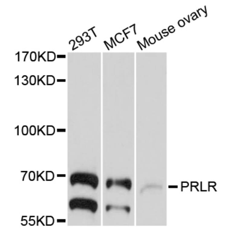 Western Blot - Anti-PRLR Antibody (A10513) - Antibodies.com