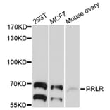 Western Blot - Anti-PRLR Antibody (A10513) - Antibodies.com