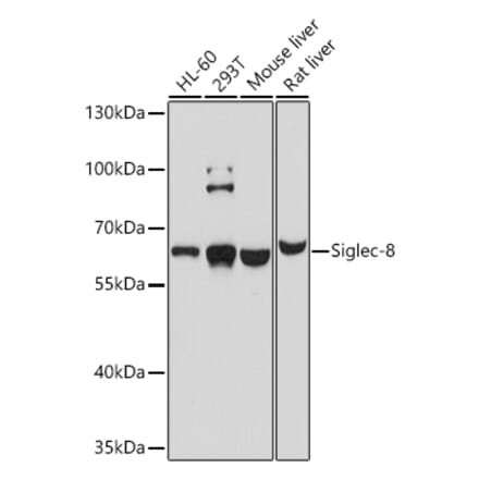 Western Blot - Anti-SIGLEC8 Antibody (A12975) - Antibodies.com