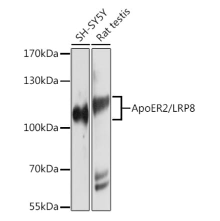 Western Blot - Anti-ApoER2 Antibody (A12976) - Antibodies.com