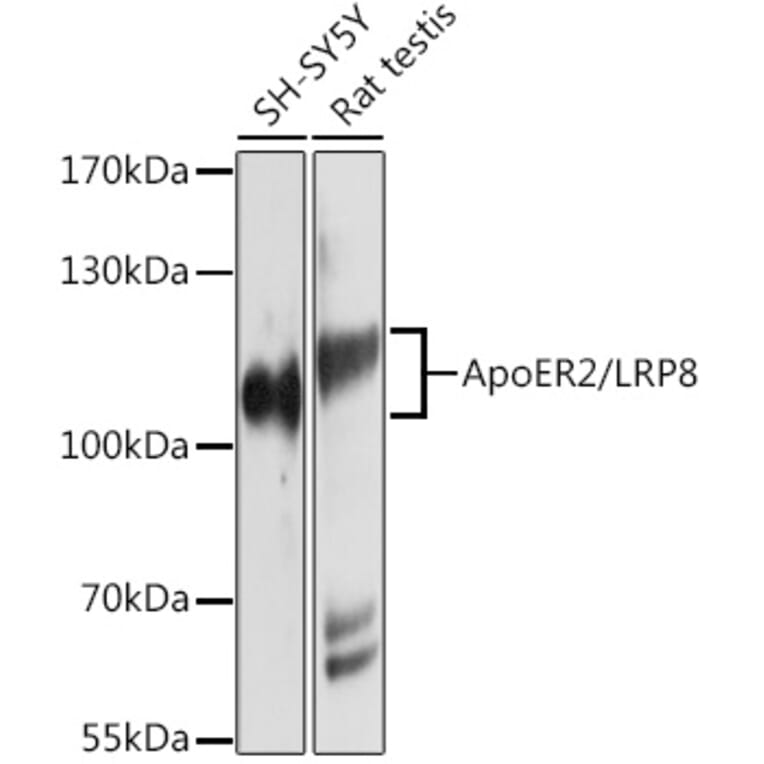 Western Blot - Anti-ApoER2 Antibody (A12976) - Antibodies.com