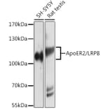 Western Blot - Anti-ApoER2 Antibody (A12976) - Antibodies.com